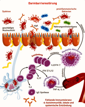 Darmbarrierestörung